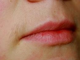 여성의 콧수염 : 왜 자라며 제거하는 방법은 무엇입니까?